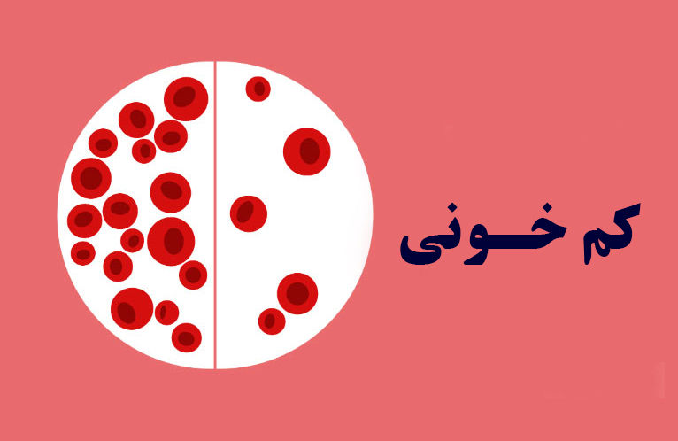 درمان کمخونی ، بدون دارو