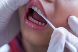 استرس چگونه دندان‌ های شما را نابود می‌کند؟