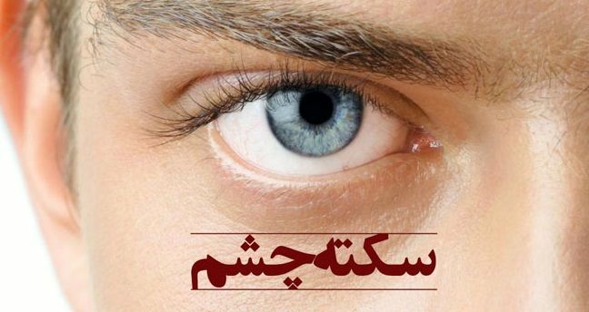 «سکته چشمی» چیست؟
